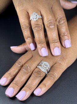 Superposición de gel de estructura con reparaciones de gel X