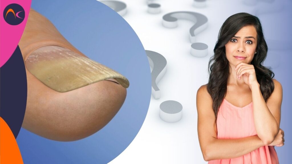 Pruebas sobre el estado de las uñas